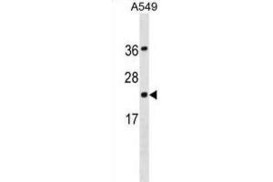 Western Blotting (WB) image for anti-Programmed Cell Death 6 (PDCD6) antibody (ABIN3001218) (PDCD6 antibody)