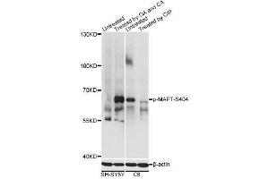 Western blot analysis of extracts of SH-SY5Y and C6 cells, using Phospho-MAPT-S404 antibody (ABIN2987503) at 1/2000 dilution.