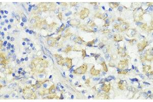 Immunohistochemistry of paraffin-embedded Human stomach using CTSB Polyclonal Antibody at dilution of 1:100 (40x lens). (Cathepsin B antibody)