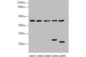 Western blot All lanes: LHX6 antibody at 3.