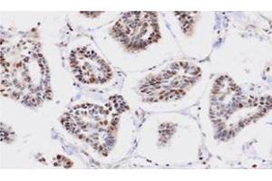 Immunohistochemistry (IHC) image for anti-Protein Phosphatase, Mg2+/Mn2+ Dependent, 1G (PPM1G) (AA 317-546) antibody (ABIN317552) (PPM1G antibody  (AA 317-546))