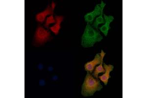 ABIN7094050 and ABIN7098094 staining Hela cells by IF/ICC. (SOAT2 antibody  (C-Term))