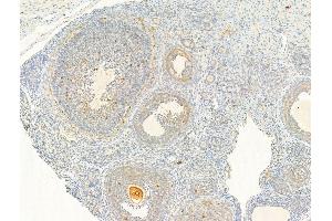 ABIN6255661 and ABIN6267025 at 1/100 staining Rat ovary tissue by IHC-P. (AKT1 antibody  (pThr308))