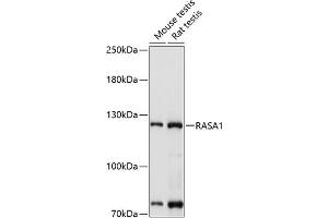 Western blot analysis of extracts of various cell lines, using R antibody (ABIN3022296, ABIN3022297, ABIN3022298 and ABIN6218715) at 1:1000 dilution. (RASA1 antibody  (AA 140-220))