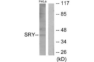 Western blot analysis of extracts from HeLa cells, using SRY antibody. (SRY antibody  (Internal Region))