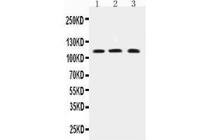 Western Blotting (WB) image for anti-Transient Receptor Potential Cation Channel, Subfamily C, Member 4 (TRPC4) (AA 961-977), (C-Term) antibody (ABIN3042531)