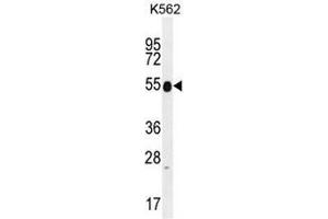 KRT25 Antibody (C-term) western blot analysis in K562 cell line lysates (35µg/lane). (Keratin 25 antibody  (C-Term))