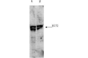 Western blot using  affinity purified anti-ECT2 pT790 antibody shows detection of endogenous phosphorylated ECT2 (arrowhead) present in cell lysates from interphase (lane 1) and mitotic (lane 2) HeLa cells. (ECT2 antibody  (pThr790))