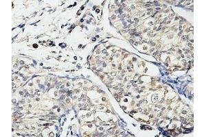 IHC analysis of formalin-fixed paraffin-embedded fetal testis, using USP29 antibody (1/100 dilution). (USP29 antibody  (AA 15-215))