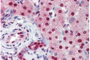 Human Liver (formalin-fixed, paraffin-embedded) stained with SSB antibody ABIN462226 followed by biotinylated goat anti-rabbit IgG secondary antibody ABIN481713, alkaline phosphatase-streptavidin and chromogen. (SSB antibody  (AA 82-131))