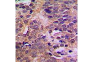 Immunohistochemistry (IHC) image for anti-Mdm2, p53 E3 Ubiquitin Protein Ligase Homolog (Mouse) (MDM2) (pSer166) antibody (ABIN7299346)