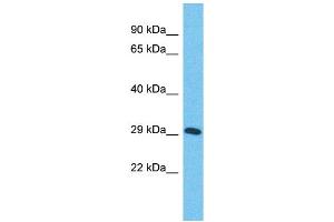 Host:  Rabbit  Target Name:  ZNF625  Sample Type:  Stomach Tumor lysates  Antibody Dilution:  1. (ZNF625 antibody  (Middle Region))