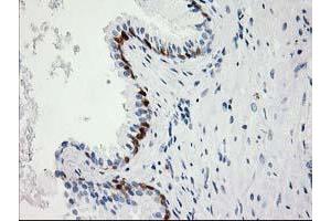 Image no. 6 for anti-Hydroxyprostaglandin Dehydrogenase 15-(NAD) (HPGD) antibody (ABIN1496363) (HPGD antibody)