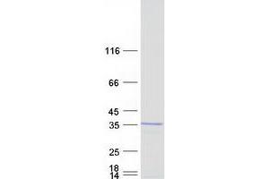 Validation with Western Blot (BCDIN3D Protein (Myc-DYKDDDDK Tag))