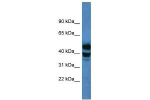 Western Blot showing CYP21A2 antibody used at a concentration of 1-2 ug/ml to detect its target protein. (CYP21A2 antibody  (C-Term))