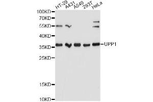 Western blot analysis of extracts of various cell lines, using UPP1 Antibody. (UPP1 antibody)