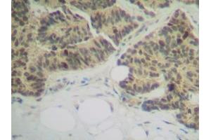 Image no. 1 for anti-Tumor Necrosis Factor Receptor Superfamily, Member 11a, NFKB Activator (TNFRSF11A) antibody (ABIN465071) (TNFRSF11A antibody)