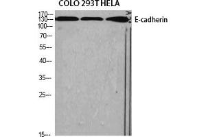 Western Blot analysis of various cells using E-cadherin Polyclonal Antibody diluted at 1:1000. (E-cadherin antibody  (AA 1-80))