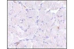 Immunohistochemistry of LIMP2 in human skeletal muscle tissue with this product at 10 μg/ml. (SCARB2 antibody  (C-Term))