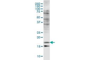Western Blotting (WB) image for anti-Cofilin 2 (CFL2) (AA 57-167) antibody (ABIN598607) (Cofilin 2 antibody  (AA 57-167))