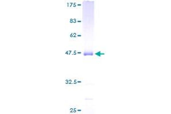 UBE2M Protein (AA 1-183) (GST tag)