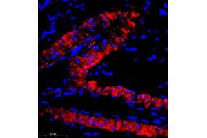 Immunofluorescence of paraffin embedded mouse thyroid gland using Cep78 (ABIN7073432) at dilution of 1:400 (400x lens)