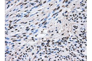 Image no. 11 for anti-ATP Synthase, H+ Transporting, Mitochondrial F1 Complex, beta Polypeptide (ATP5B) antibody (ABIN1496766) (ATP5B antibody)