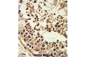 Immunohistochemistry (IHC) image for anti-TATA Box Binding Protein (TBP) antibody (ABIN3002745) (TBP antibody)