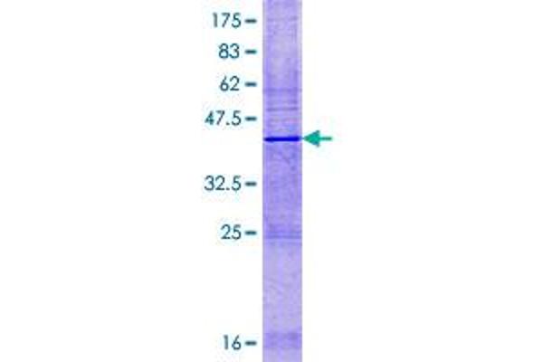 HSD11B1L Protein (AA 1-152) (GST tag)