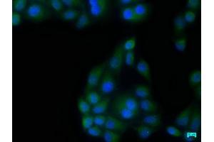 Immunofluorescence staining of Hela cells with ABIN7140130 at 1:133, counter-stained with DAPI. (TBK1 antibody  (AA 644-661))