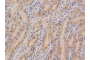 DAB staining on IHC-P; Samples: Rat Kidney Tissue (GSTa5 antibody  (AA 1-221))