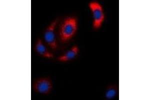 Immunofluorescent analysis of MKK6 staining in Hela cells. (MAP2K6 antibody  (N-Term))