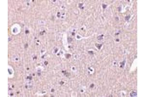 Immunohistochemistry of CRMP in human brain tissue with CRMP antibody at 2 μg/ml.