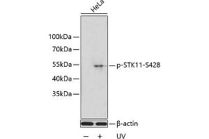 Western blot analysis of extracts of HeLa cells, using Phospho-STK11-S428 antibody (ABIN6135323, ABIN6136262, ABIN6136263 and ABIN6225619). (LKB1 antibody  (pSer428))