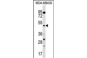 Western blot analysis in MDA-MB435 cell line lysates (35ug/lane). (Sorting Nexin 4 antibody  (C-Term))