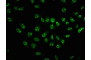 Immunofluorescence staining of Hela cells with ABIN7127715 at 1:100,counter-stained with DAPI. (Recombinant MTOR antibody  (pSer2481))