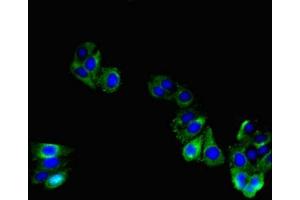 Immunofluorescent analysis of HepG2 cells using ABIN7171759 at dilution of 1:100 and Alexa Fluor 488-congugated AffiniPure Goat Anti-Rabbit IgG(H+L) (TNMD antibody  (AA 131-254))