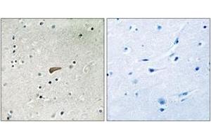 Immunohistochemistry analysis of paraffin-embedded human brain, using FRS2 (Phospho-Tyr436) Antibody. (FRS2 antibody  (pTyr436))