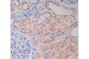 IHC-P analysis of kidney tissue, with DAB staining. (LRRFIP1 antibody  (AA 615-735))