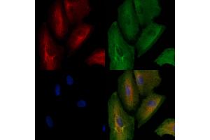 ABIN6262847 and ABIN6278586 staining  cells by IF/ICC. (KLHL3 antibody  (N-Term))