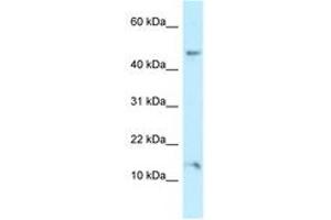 Image no. 1 for anti-Pleckstrin Homology Domain Containing, Family J Member 1 (PLEKHJ1) (AA 86-135) antibody (ABIN6747910) (GNRPX antibody  (AA 86-135))