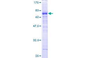 HPD Protein (AA 1-393) (GST tag)
