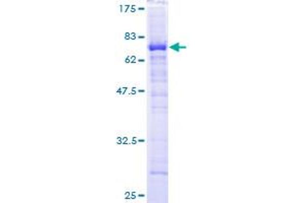 HPD Protein (AA 1-393) (GST tag)