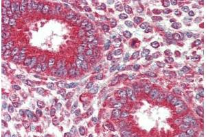 Human Uterus (formalin-fixed, paraffin-embedded) stained with KIF5B antibody ABIN337215 at 2. (KIF5B antibody  (AA 951-963))