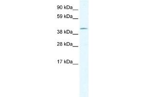 WB Suggested Anti-GIOT-1 Antibody Titration:  1. (ZNF461 antibody  (N-Term))
