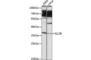 Western blot analysis of extracts of various cell lines, using IL12B antibody (ABIN6129400, ABIN6142296, ABIN6142297 and ABIN6216855) at 1:3000 dilution. (IL12B antibody  (AA 23-328))