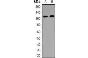 Western blot analysis of USP37 expression in HeLa (A), mouse brain (B), rat brain (C) whole cell lysates. (USP37 antibody)