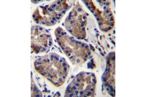 SLC9A2 Antibody (C-term) (ABIN656633 and ABIN2845878) immunohistochemistry analysis in formalin fixed and paraffin embedded human stomach tissue followed by peroxidase conjugation of the secondary antibody and DAB staining. (SLC9A2 antibody  (C-Term))