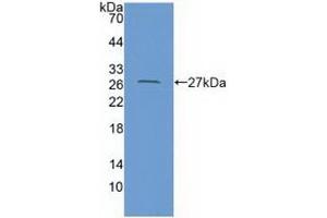 Detection of Recombinant CXADR, Human using Polyclonal Antibody to Coxsackie Virus And Adenovirus Receptor (CXADR) (Coxsackie Adenovirus Receptor antibody  (AA 20-229))