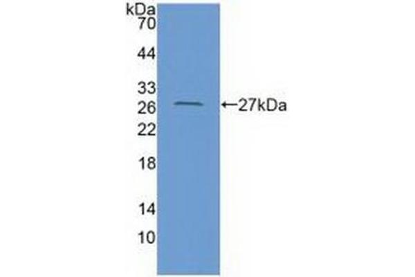 Coxsackie Adenovirus Receptor 抗体  (AA 20-229)